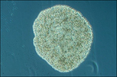 En plakozo (Trichoplax adhaerens)