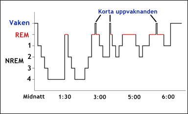 Sömnens olika stadier