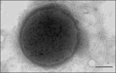 Thermococcus  gammatolerans, en arké