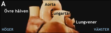 Hjärtats blodkärl