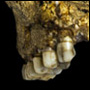 Kindtänder av Paranthropus