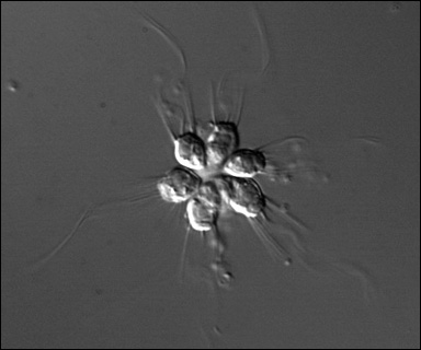 Koanoflagellater