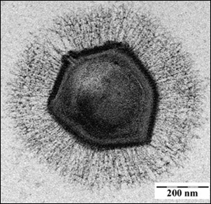 Mimivirus, ett jättestort virus