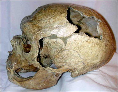 Skalle av neandertalmänniska