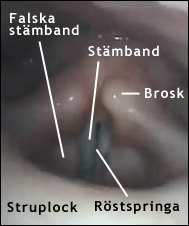 Stämband och falska stämband